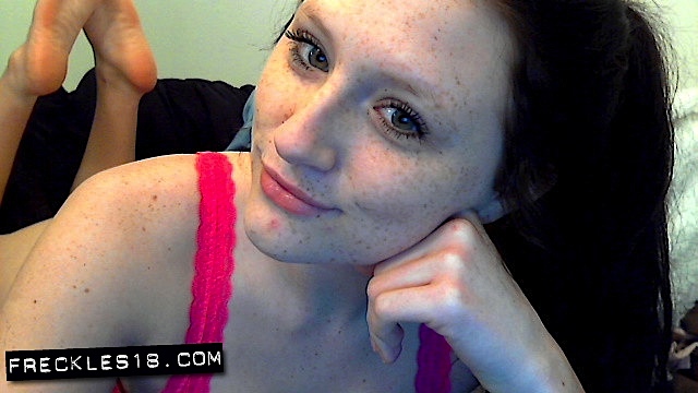 Freckles 18 #1
